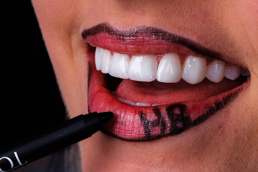 Sorriso de paciente da HB Dental Design com o contorno dos lábios desenhado a lápis