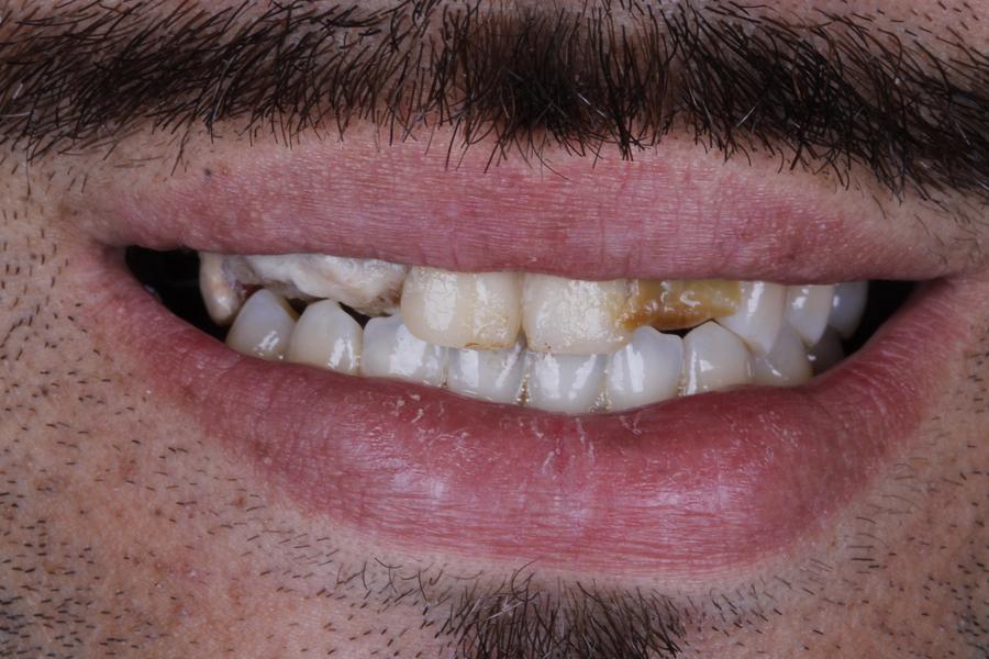 Sorriso antes do tratamento, caso 2
