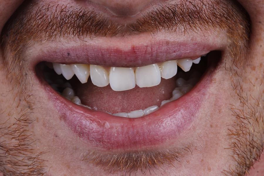 Sorriso antes do tratamento, caso 3