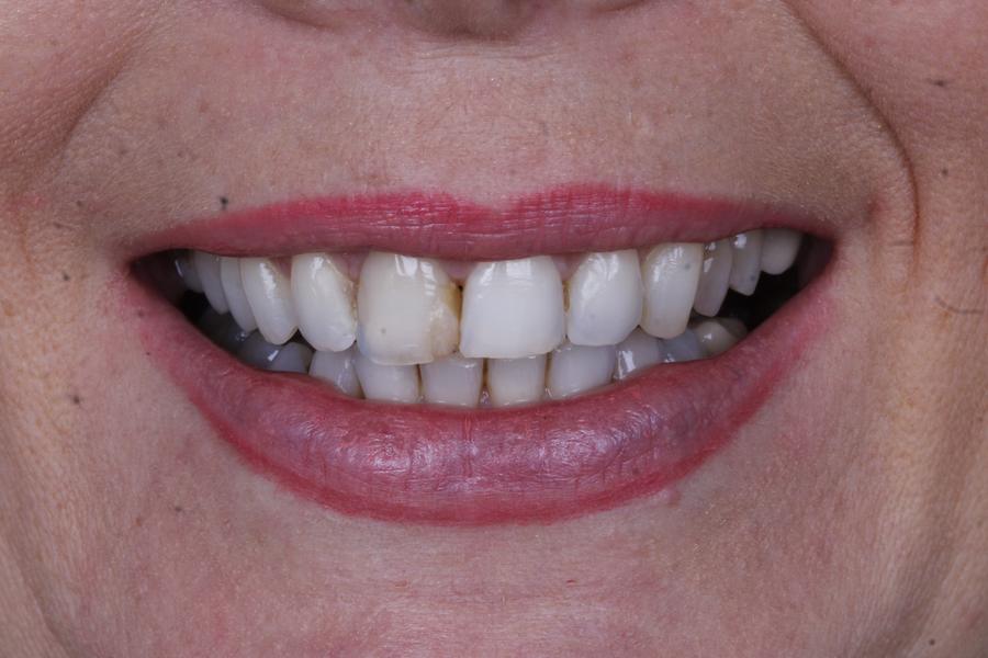 Sorriso antes do tratamento, caso 4